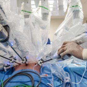 Live meekijken met robotoperatie in het Catharina Ziekenhuis via krantenwebsites