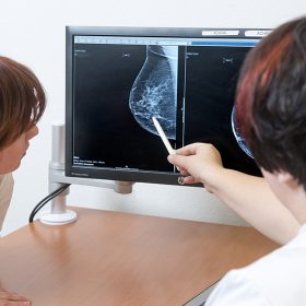 Efficiëntere borstkankerscreening door betere beoordeling mammogram