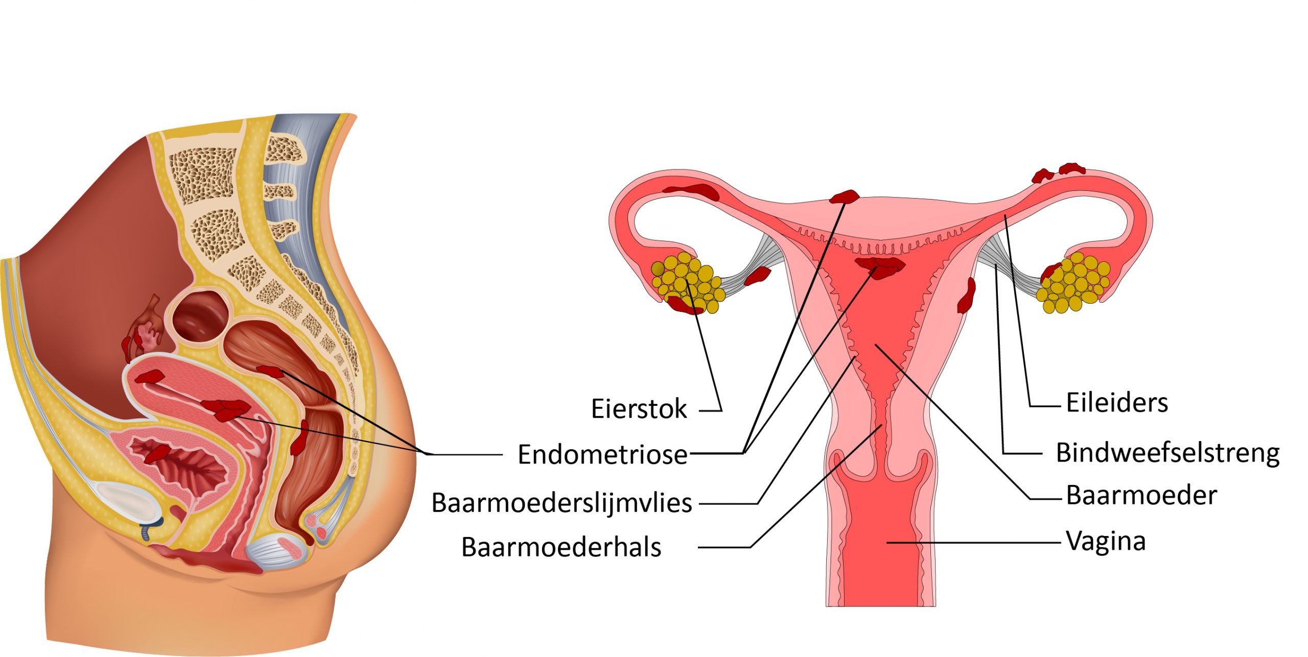 Omringd Kreta Theseus Endometriose (Folder) - Catharina Ziekenhuis